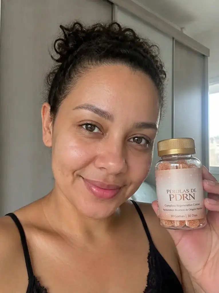 Camila Souza, 36 anos depois do tratamento com Pérolas de PDRN