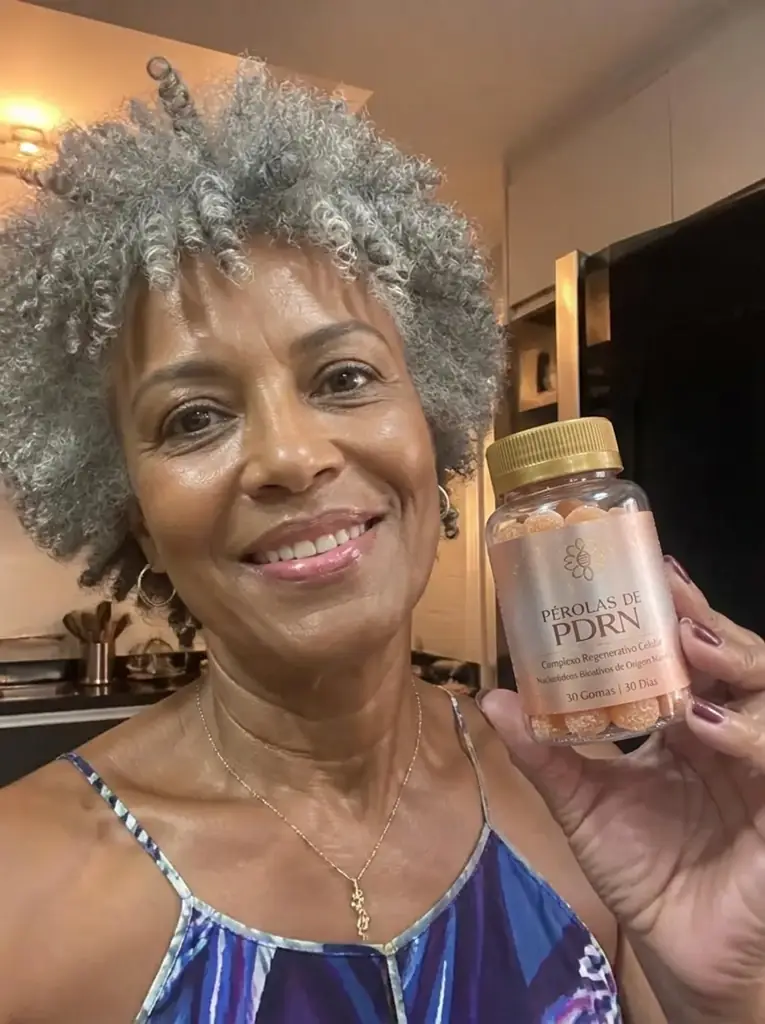 Dona Neide, 58 anos depois do tratamento com Pérolas de PDRN