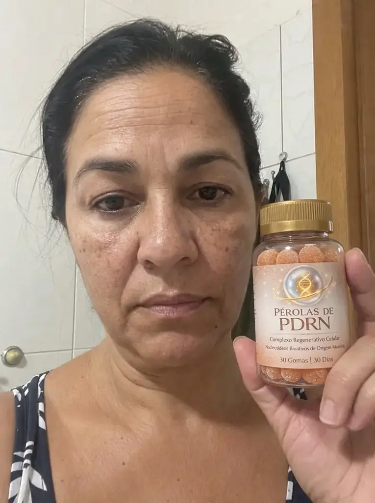Pele antes do tratamento com Pérolas de PDRN